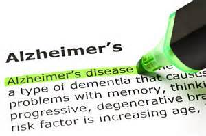 5 Signs of Alzheimer's That Show Up Before Memory Loss