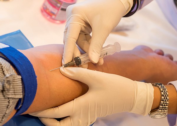 Blood Test for Alzheimer's Coming Soon