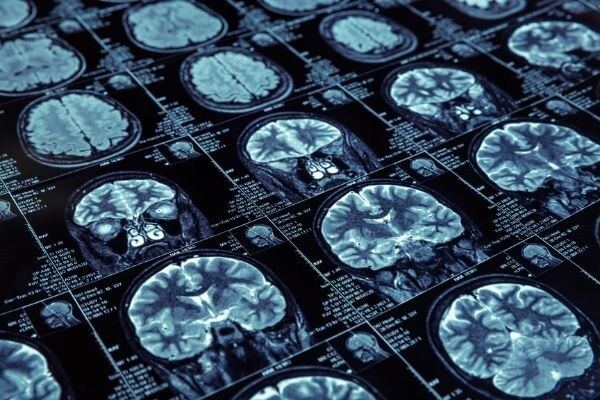 Medical Imaging - Key Partner in Today's Health Care